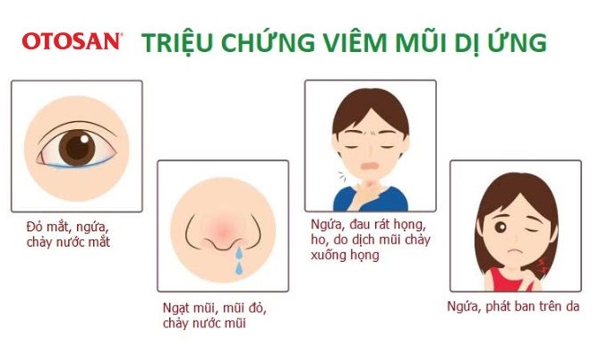trieu-chung-viem-mui-di-ung-thuong-gap