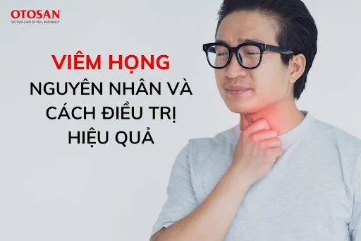 Viêm họng là gì? Nguyên nhân và cách điều trị viêm họng hiệu quả