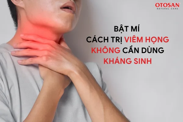 BẬT MÍ CÁCH TRỊ VIÊM HỌNG KHÔNG CẦN DÙNG KHÁNG SINH