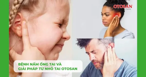 BỆNH NẤM ỐNG TAI VÀ GIẢI PHÁP TỪ NHỎ TAI OTOSAN