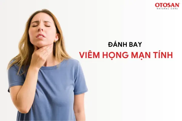 ĐÁNH BAY VIÊM HỌNG MÃN TÍNH NHỜ BIẾT NHỮNG ĐIỀU SAU