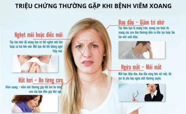 VIÊM XOANG TÁI PHÁT KHI GIAO MÙA: CÁC LOẠI THUỐC ĐIỀU TRỊ?